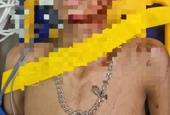 Adolescente de 16 anos é apreendido suspeito de esfaquear jovem no bairro Manoel Teles, em Arapiraca