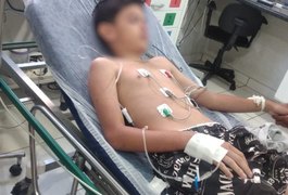 Garoto que comeu lagartixa frita servida pela madrasta volta a ser internado após passar mal