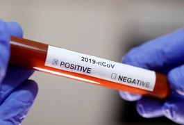 Covid-19: Arapiraca registra 8.202 casos e mais um óbito nesta quinta (30)