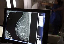 Ministério da Saúde passa a recomendar mamografia a partir dos 40 anos