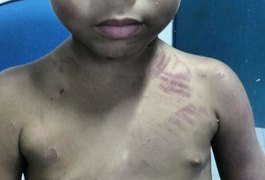 Pai é denunciado por torturar filho de três anos dentro de casa no Vergel, em Maceió