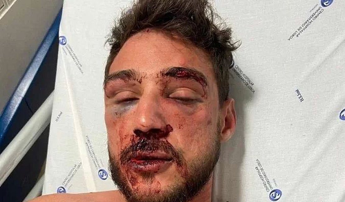 'Não tenho medo de ameaças, vou até o fim', diz alagoano agredido em Portugal