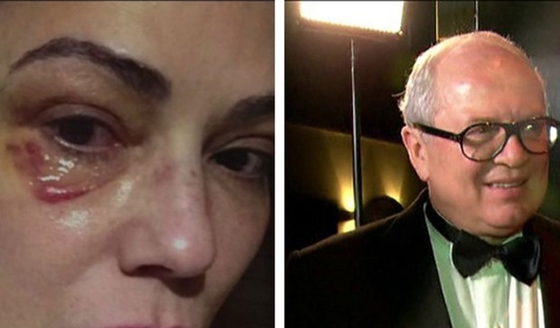 Defesa diz que ex-marido tem prova de 'descontrole' de Luiza Brunet