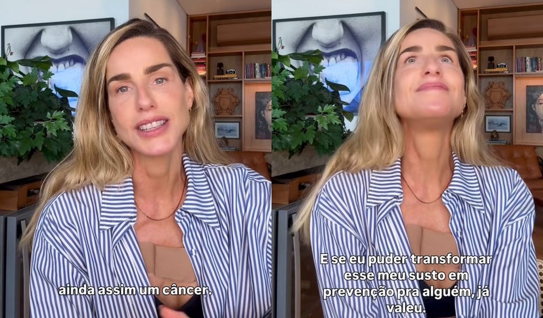 Modelo Mariana Weickert anuncia diagnóstico de câncer de pele e faz alerta: 'Poderia ter sido evitado'