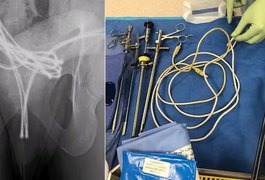 Homem de 21 anos é hospitalizado com cabo USB na uretra