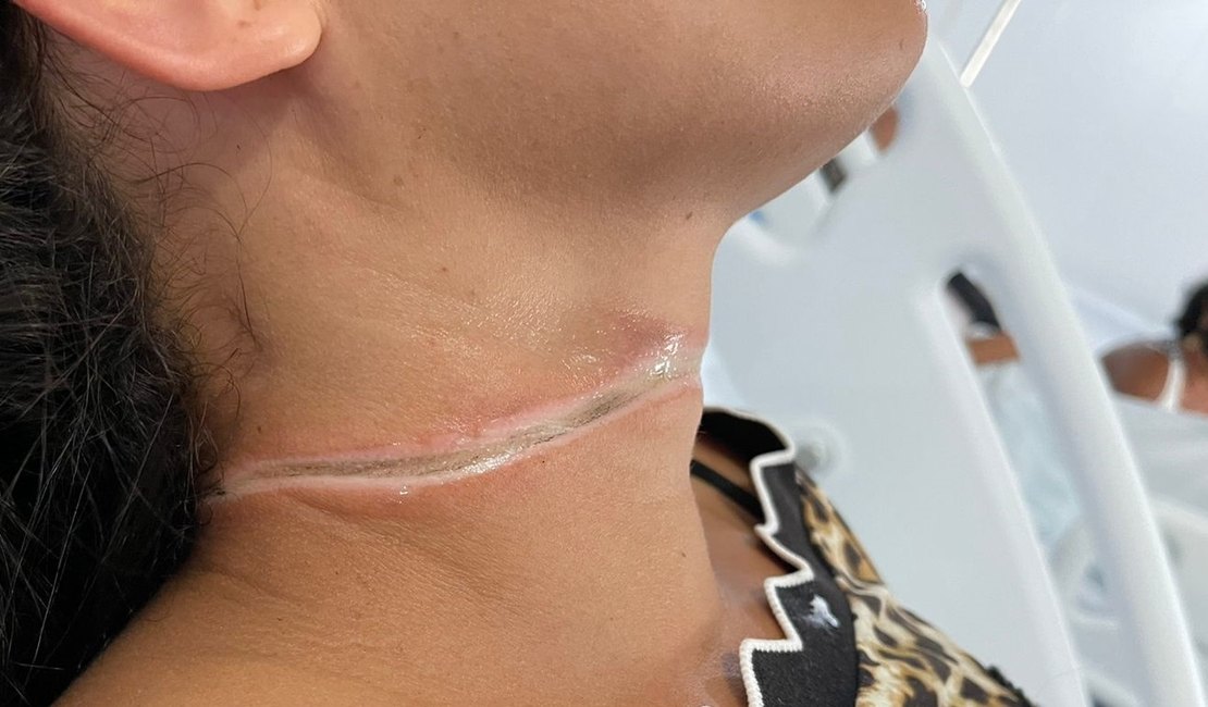 Fiação de internet solta de poste, causa acidente e deixa jovem ferida, no Sertão