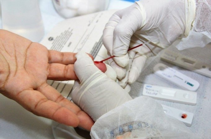 Remédio injetável que previne HIV pode entrar no SUS até o fim o ano