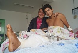 HGE registra mais de 4 mil pacientes vítimas de acidentes de moto em Alagoas