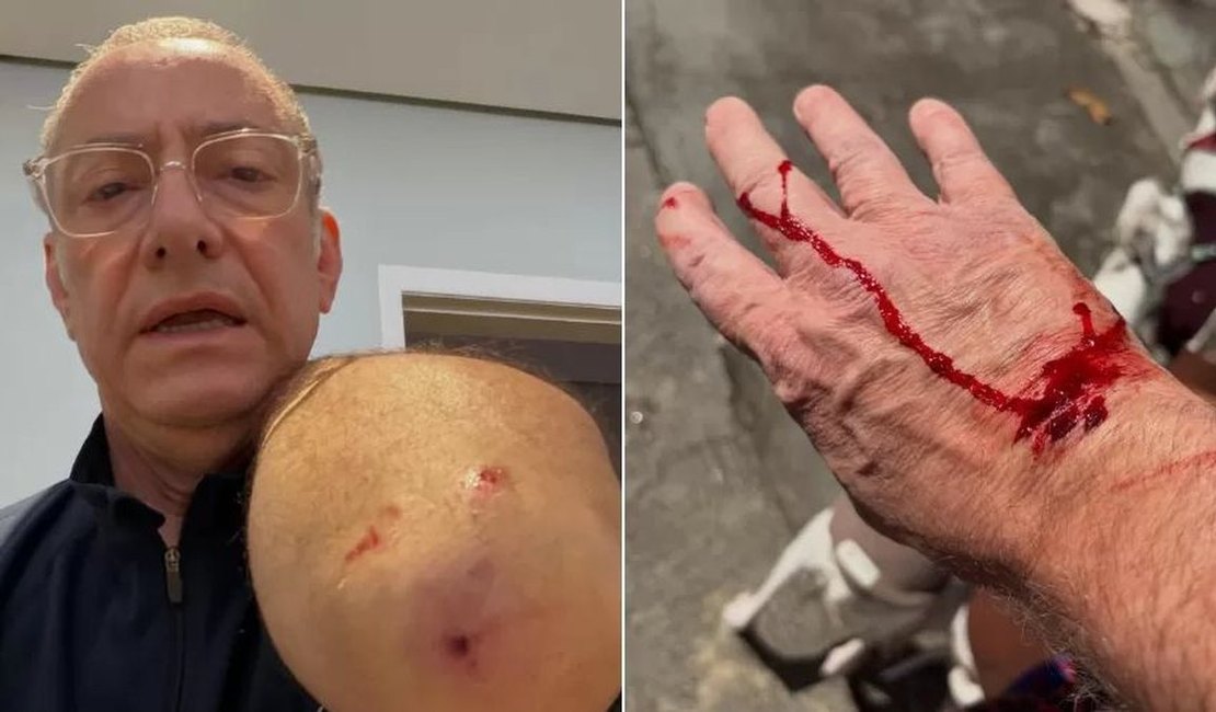 Jornalista da Globo é atacado por pitbull sem guia