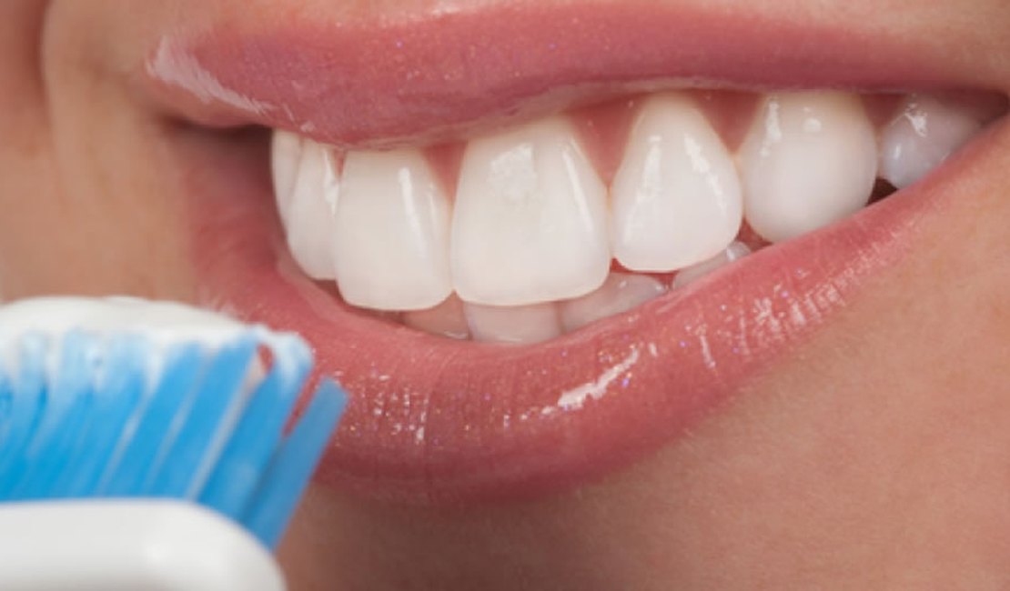 Qual é o melhor tipo de clareamento dental: procedimentos e técnicas