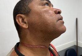 Mototaxista quase é degolado por fio na estrada em Marechal Deodoro