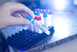 Covid-19: Sobe para 117 o número de óbitos em Arapiraca e 4.937 casos confirmados