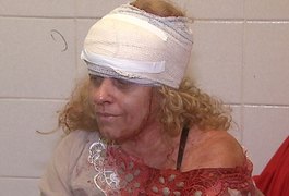 Aluno agride diretora de escola com socos e golpes de caneta, em Sergipe