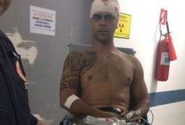 Policial atingido por tiro na cabeça durante operação segue internado na UTI do HGE, em Maceió