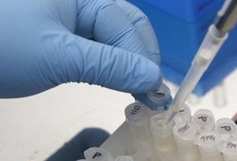 Vacina para Zika estará disponível para testes em novembro