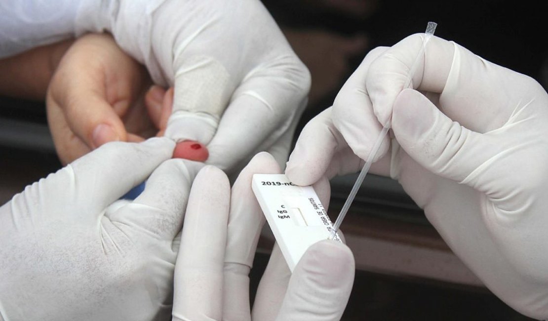 COVID-19:Arapiraca não registra óbitos há mais de 10 dias