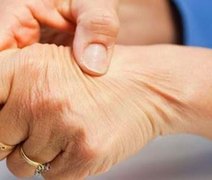 Plano de saúde terá de arcar com medicamento para esclerose múltipla