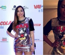 Anitta reclama da aparência em fotos de sites: 'Parece que engoli um ovo'