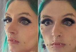Mulher viraliza com 'piercing' em globo ocular: 'Como você pisca?'