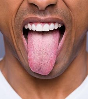 12 sinais de alerta na língua que jamais deve ignorar