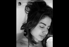 Em post, Lábios de Anitta chamam atenção por volume