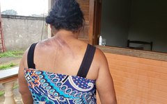 Vítima sobrevivente