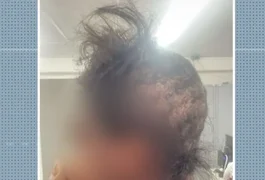 Influenciadora adolescente é sequestrada, faz PIX e tem cabeça raspada por criminosos em cativeiro, em Salvador