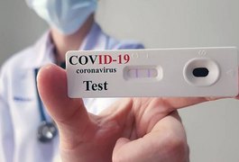 Cai para 36 números de novos infectados pelo coronavírus nas últimas 24 horas