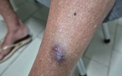Idosa foi agredida por sobrinha que é médica, em Arapiraca