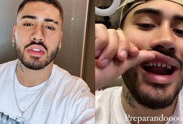 Kevinho sorri sem as lentes de contato e deixa seguidores impressionados