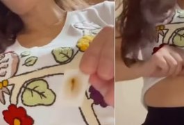 Moda do adesivo de umbigo falso chega ao Brasil e divide opiniões na internet; entenda