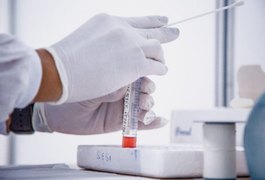 Central de Triagem de Arapiraca inicia testes RT-PCR nesta terça-feira (16)