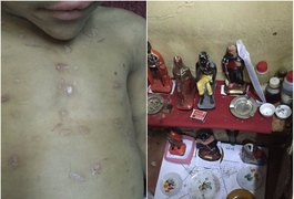 Tios-avós são acusados de torturar menino de 5 anos em suposto ritual de magia