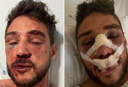 Bar em Lisboa diz que vai 'apurar responsáveis' pela agressão de alagoano e namorado