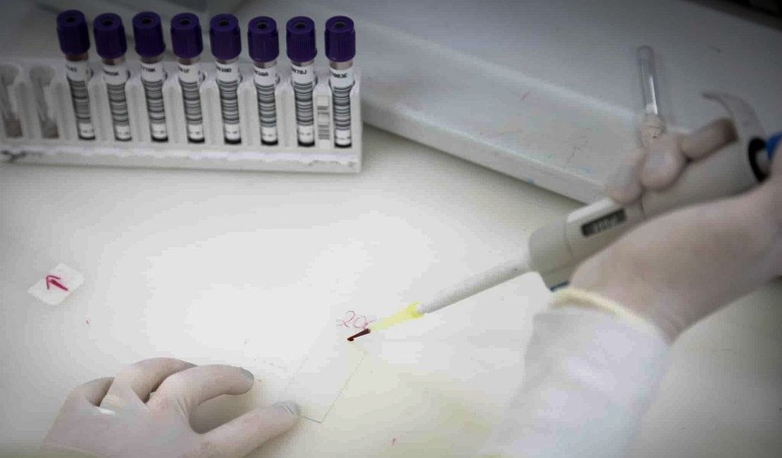 Paciente em SP com suspeita de ebola testa positivo para meningite