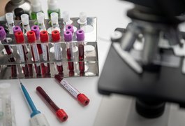 Boletim Covid-19: Alagoas registra 37 casos e seis óbitos