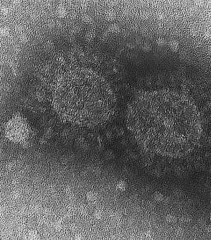 Variante do coronavírus identificada no interior já circulava desde janeiro em São Paulo