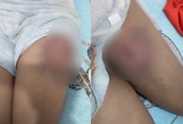 Homem que feriu PM com pedrada em Teotônio Vilela é solto após decisão da Justiça