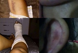 Ex-companheira de campeão de MMA afirma que sofreu violência doméstica em Arapiraca