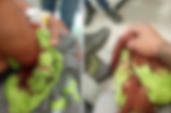 Funcionários da BRK são atacados com facão durante serviço em Atalaia