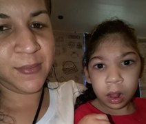 Mãe faz 'vaquinha' a fim de obter cadeira de rodas para filha com microcefalia