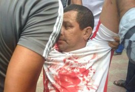 Policial Militar é baleado durante tentativa de assalto em União dos Palmares