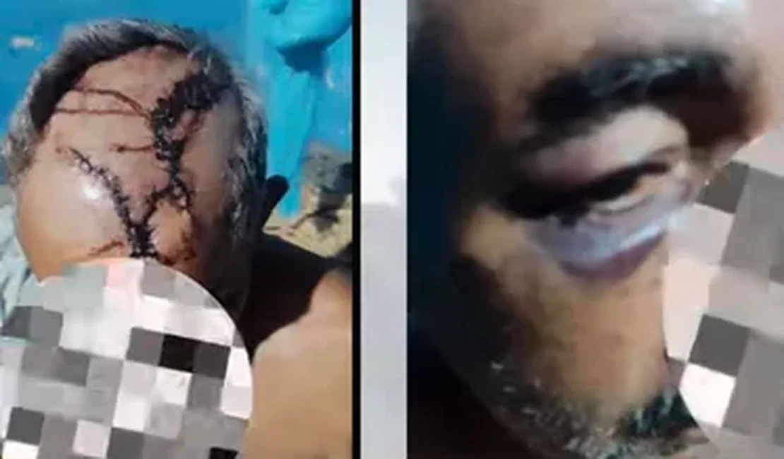 Suspeitos de agredir idoso a pedradas e pauladas são capturados pela PCAL