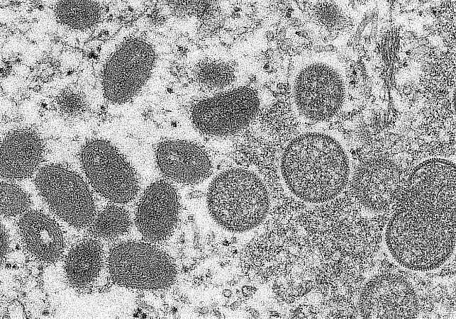 Sobe para 34 o número de casos em investigação de varíola dos macacos em Alagoas