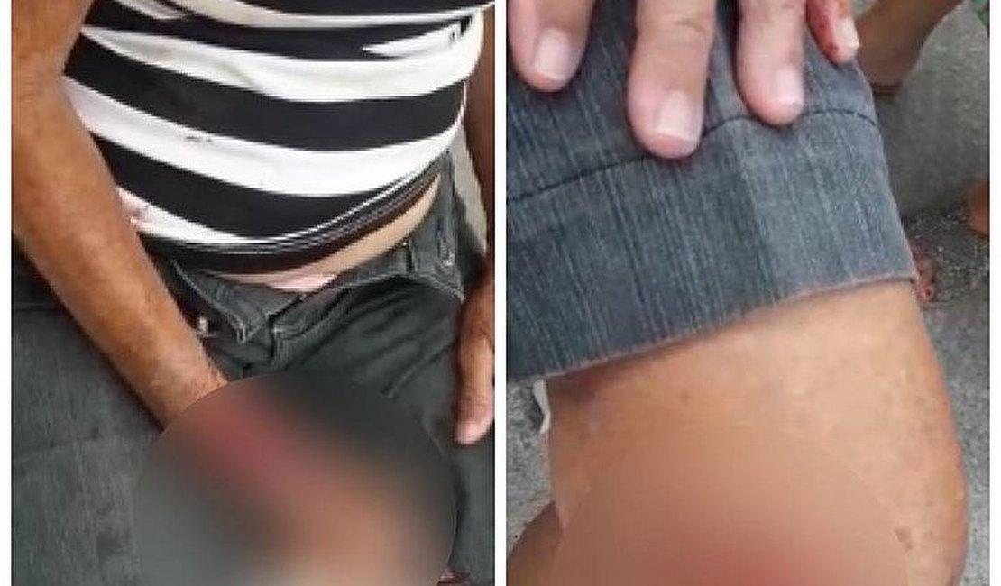 Idosa de 82 anos é atropelada duas vezes seguidas e fica ferida em Maceió