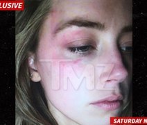 Esposa de Johnny Depp pede divórcio após agressão, diz site