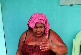 Professora espancada por ex-aluno encontra-se na UTI do HEA, em Arapiraca