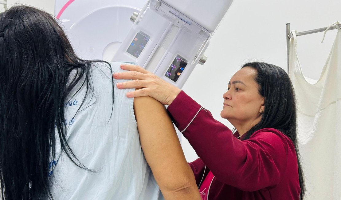 Hospital da Mulher de Alagoas disponibiliza mamografia sem agendamento
