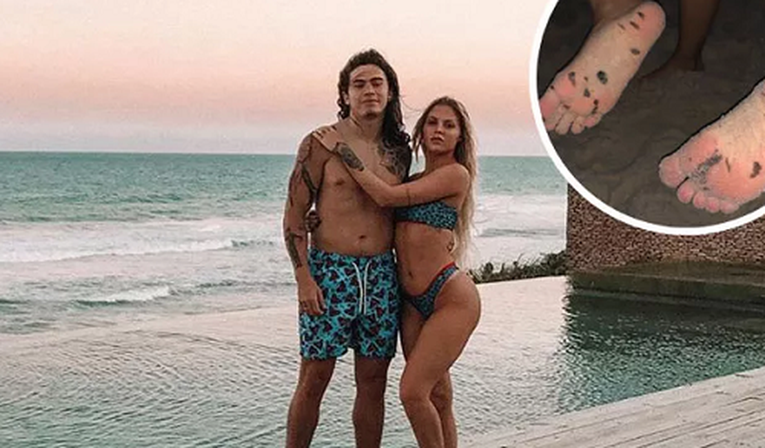 De férias em Alagoas, Whindersson Nunes mostra manchas de óleo nos pés