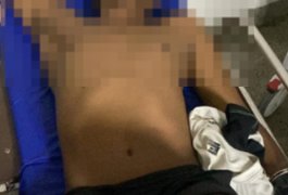 Suspeito de envolvimento no assassinato de sargento reformado dá entrada no HGE com perfuração em perna